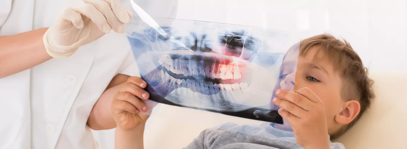 Diagnostic Care and Dental X-rays