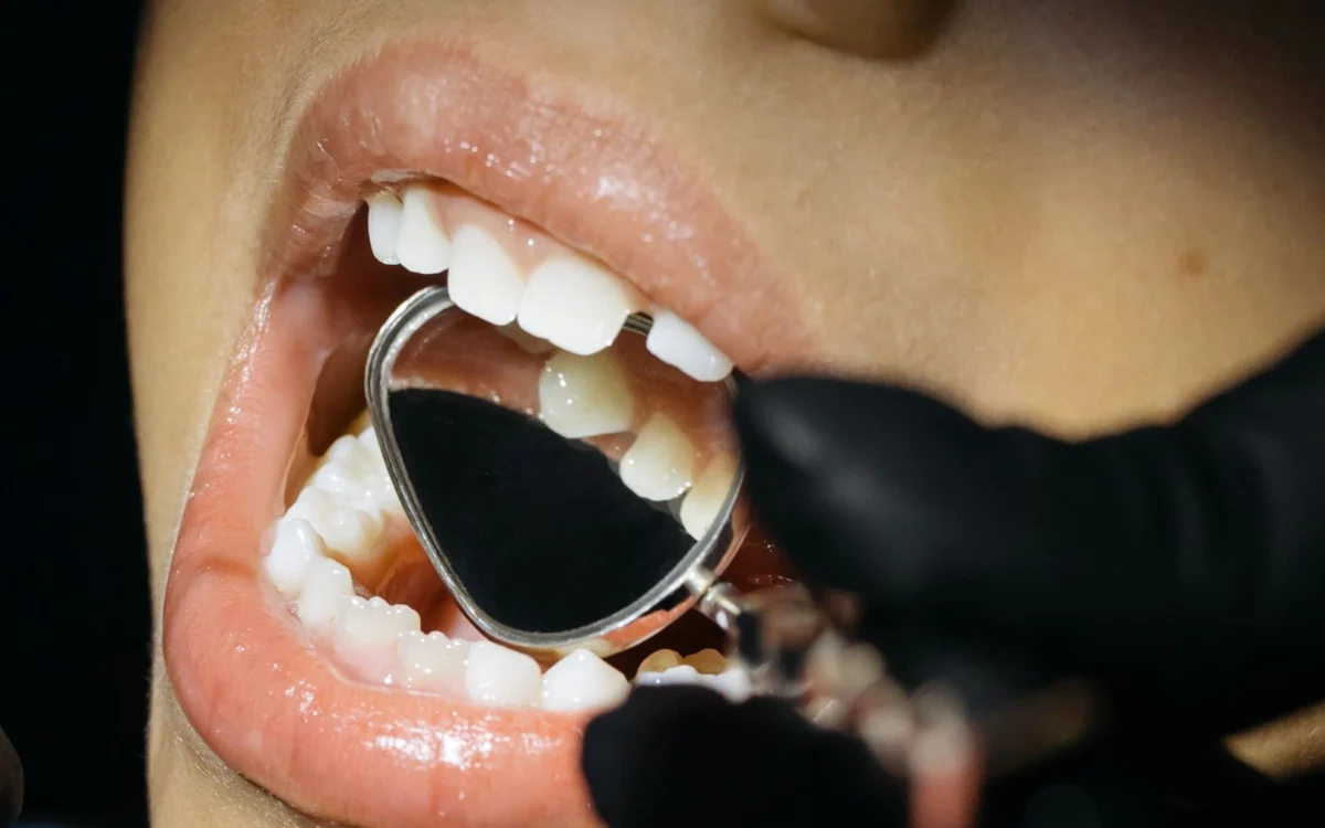 Can Holistic Dentistry Reduce Dental Anxiety in Kids? A Gentle, Whole-Child Approach
