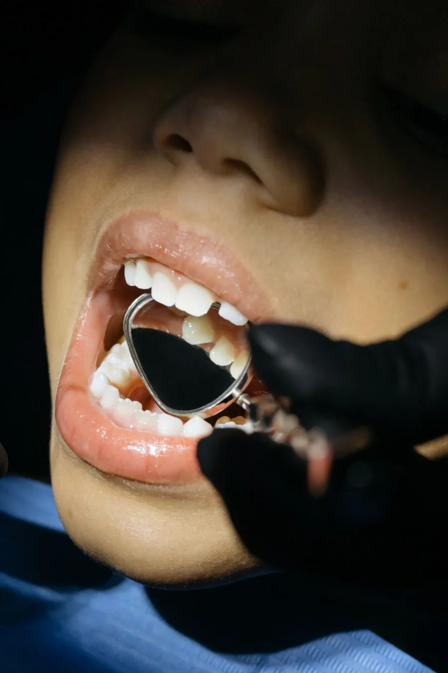 Can Holistic Dentistry Reduce Dental Anxiety in Kids? A Gentle, Whole-Child Approach